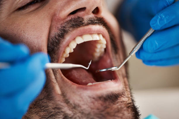 Best Cosmetic Emergency Dentistry in Arlington Heights, WA
